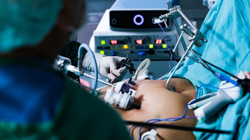 Procedura de chirurgie bariatrica pe cale laparoscopica
